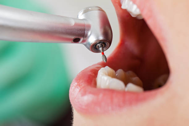 Best Emergency Dental Care for Broken or Chipped Teeth in Cranford, NJ